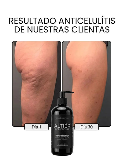 ALTIER by Orelvie - Emulsión Anticelulitis + Antiflacidez