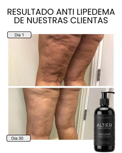 ALTIER by Orelvie - Emulsión Anticelulitis + Antiflacidez