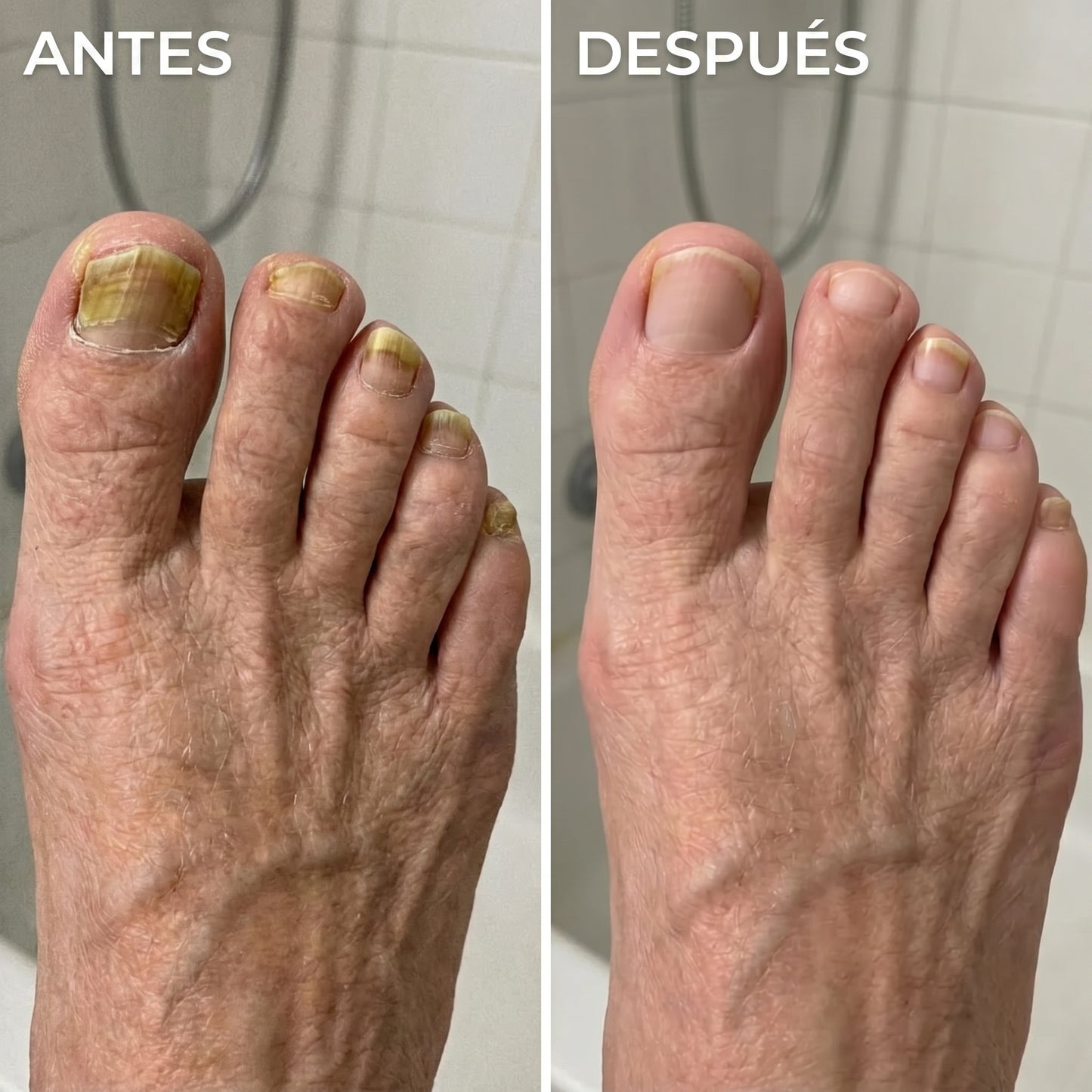 Lápiz para el Cuidado y Restauración de Uñas by ORELVIE™