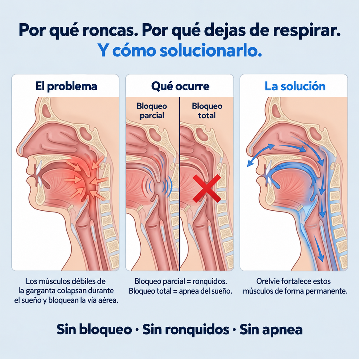 Orelvie - Elimina los Ronquidos y la Apnea del Sueño