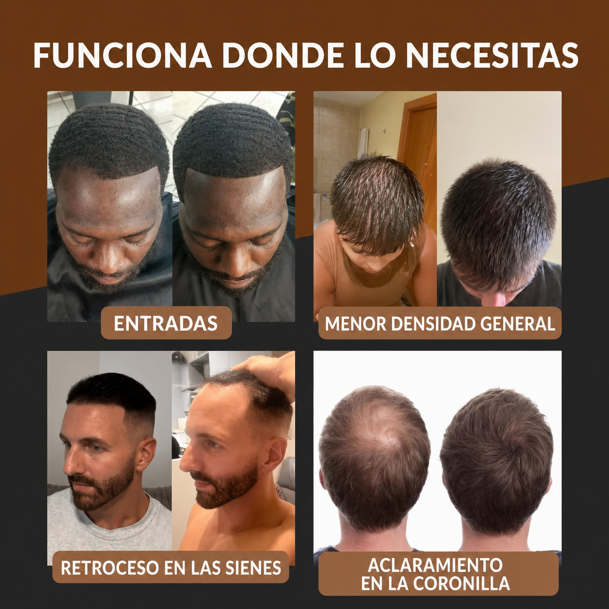 Densificador Capilar by Orelvie