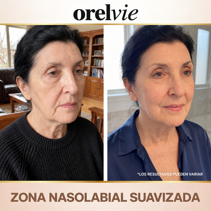 Sérum Koreano - Efecto Lifting desde la primera aplicación