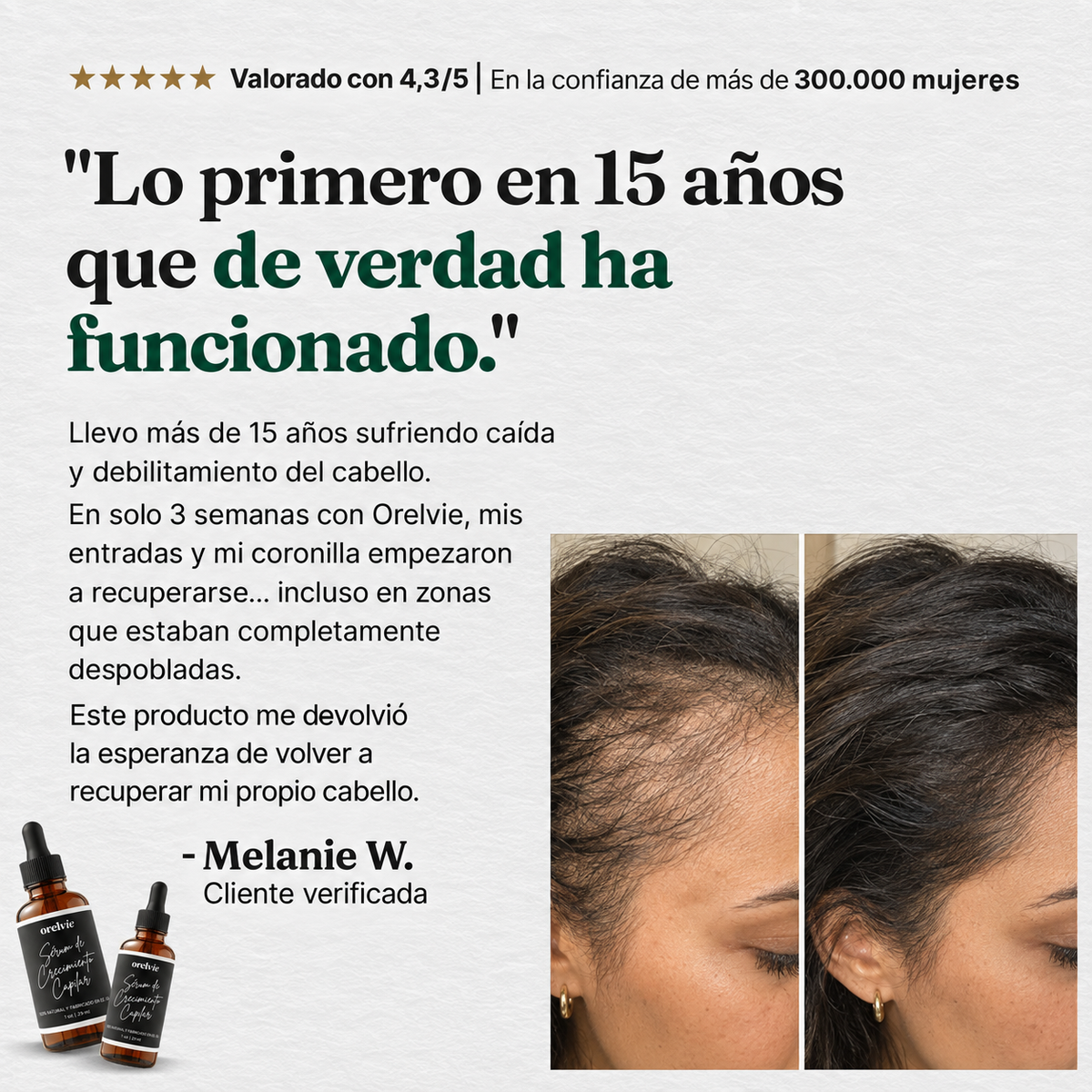 Sérum para el Crecimiento del Cabello de Orelvie