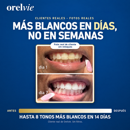 Dientes más blancos en minutos -  Lápiz blanqueador Orelvie™ Pro Gold