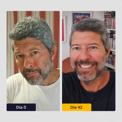 Crema facial antiedad by Orelvie