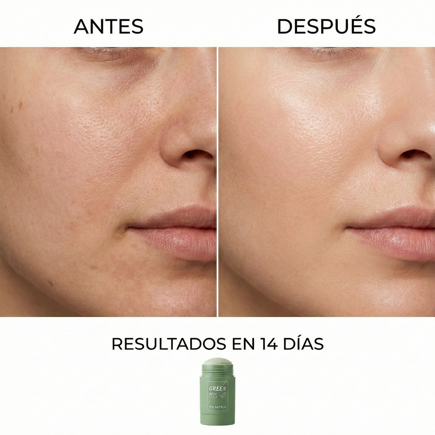 GREENSTICK™ - Mascarilla Hidratante (Producto Viral 2026)